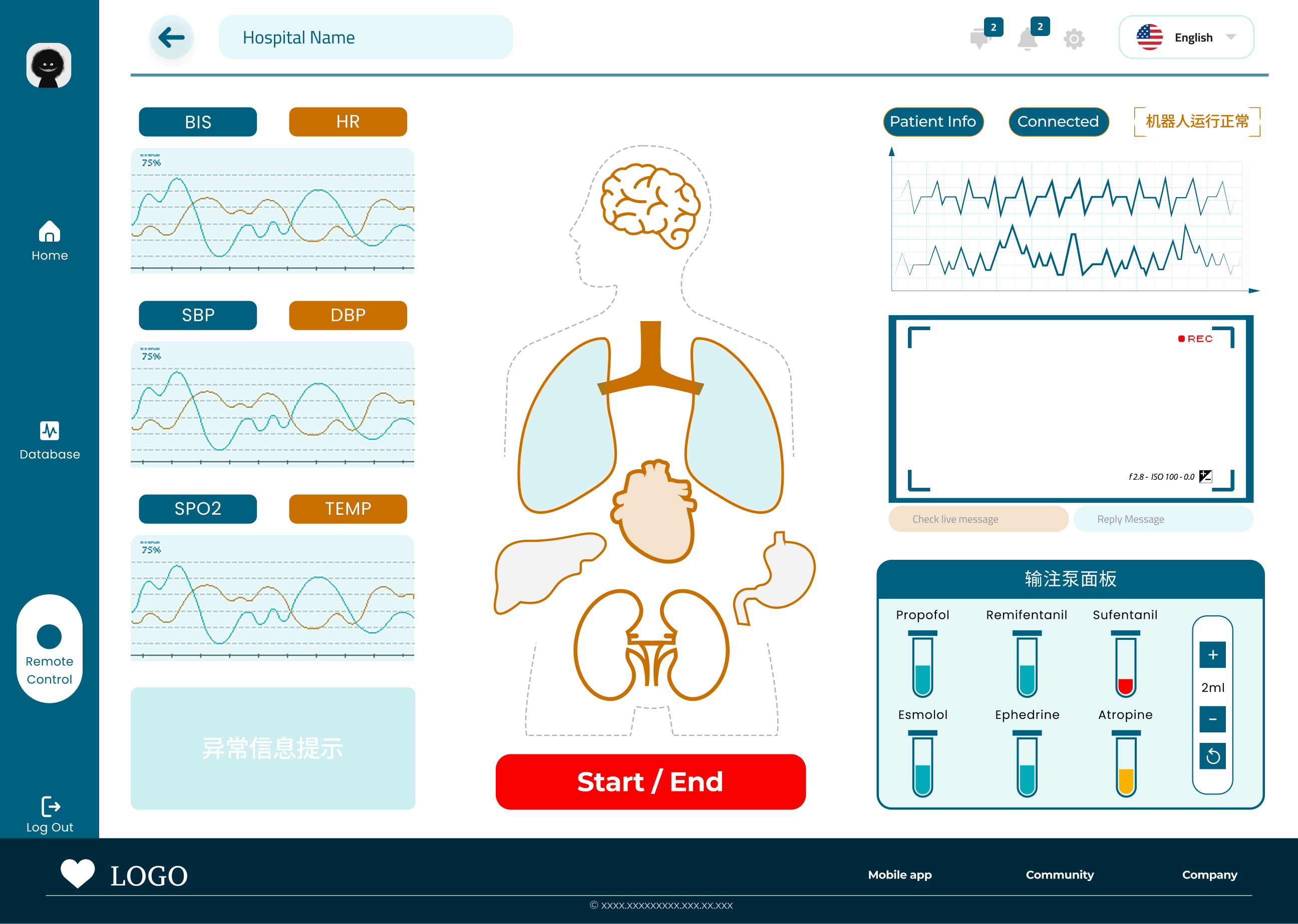 Remote control in-session screen