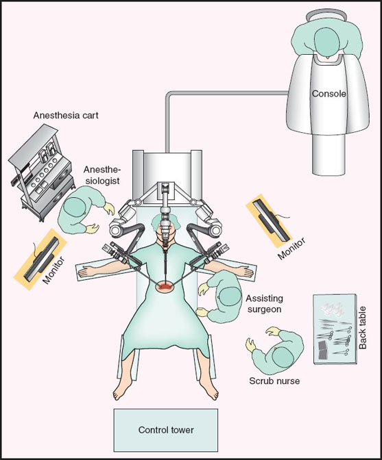 Operating room robot system layout